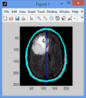 پروژه طبقه بندی تصویر MRI با آنتروپی موجک براساس شبکه عصبی احتمالی PNN توسط MATLAB