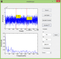 پروژه پردازش سیگنال و صدا به روش LPC با MATLAB