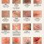 طبقه بندی ضایعه های پوستی از تصاویر با الگوریتم PCA و لبه یابی با Canny در متلب