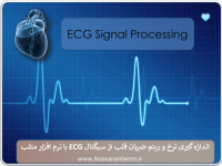 اندازه گیری نرخ و ریتم ضربان قلب از سیگنال ECG با متلب